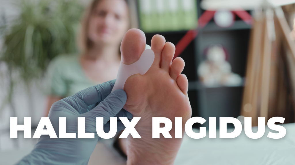 hallux rigidus