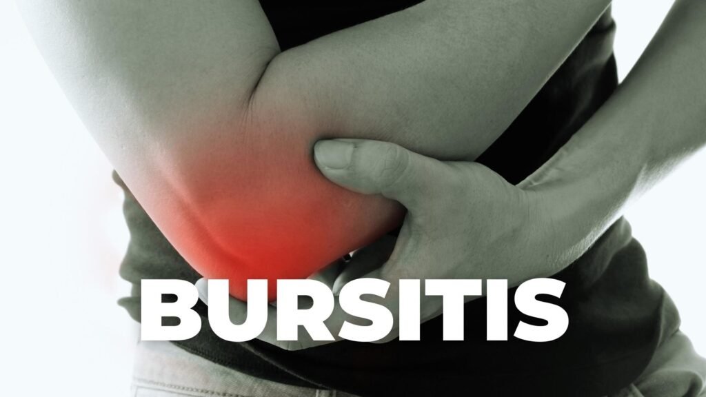 bursitis dr abel cruz